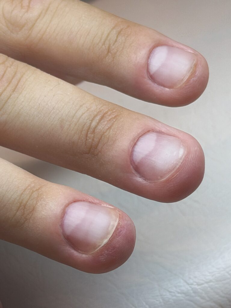 Nach diesem Kurs – und mit der Routine, die du dir anschließend im Studio aufbaust – wirst du in der Lage sein: – Ein komplettes Neuset für Männer inklusive Maniküre in ca. 1 Stunde zu erarbeiten. – Clevere Lifehacks für den zeitsparenden Aufbau von Nude- oder Babyboomer-Nägeln sicher anzuwenden. – Ein komplettes Neuset „Nude Nails“ für Frauen inklusive Maniküre ebenfalls in nur 1 Stunde umzusetzen!